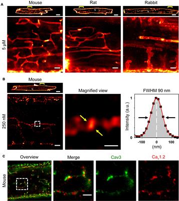 Axial Tubule Junctions Activate Atrial Ca2+ Release Across Species